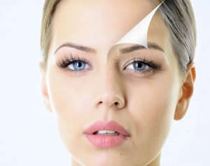 Model with simulated anti wrinkle treatment before and after